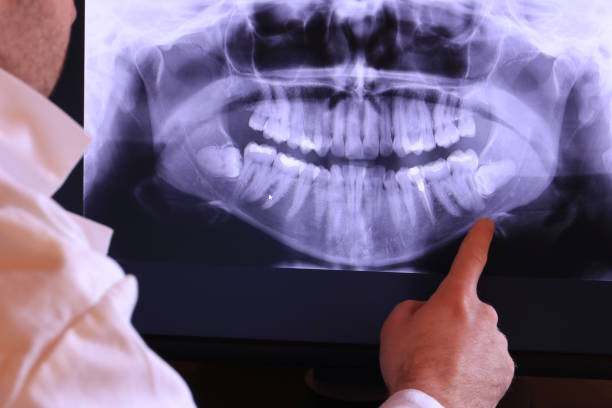 Best Emergency Gum Treatment in Danvers, IL