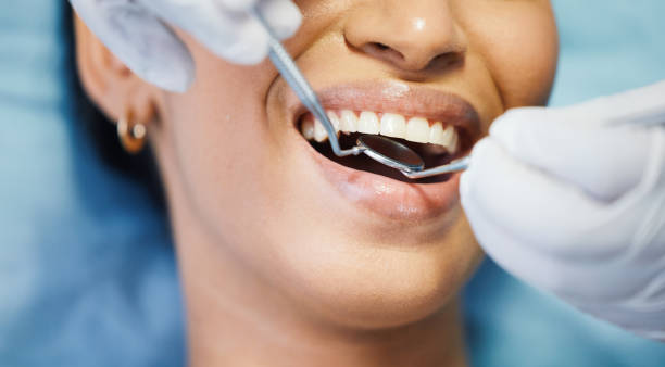 Best Emergency Tooth Extraction in Danvers, IL