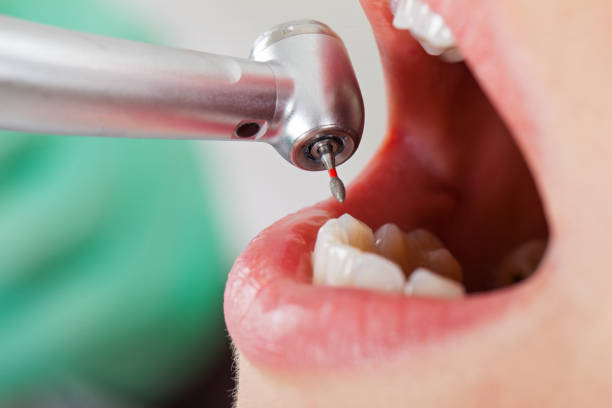 Best After-Hours Dental Trauma Care in Danvers, IL